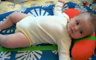 Trẻ bị hội chứng West có phát triển bình thường được không?