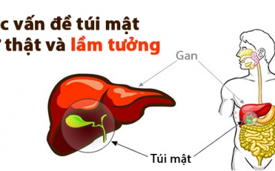 Một vài quan niệm sai lầm về các vấn đề túi mật