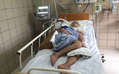 Cảnh báo: Rắn độc cắn người lại vào mùa!