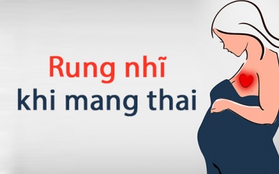Phụ nữ mang thai bị rung nhĩ quản lý bệnh thế nào?