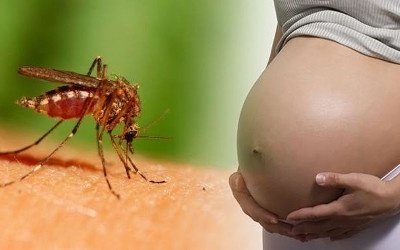 Dịch Zika tràn ra toàn thành, 51 thai phụ nhiễm bệnh
