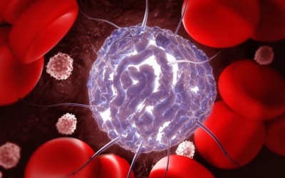 Những điều cần biết về ghép tế bào gốc điều trị ung thư máu