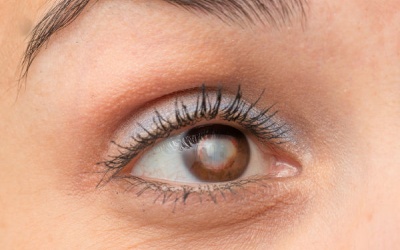 Những phương pháp đơn giản giảm đục thủy tinh thể