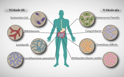 Những bí ẩn khó tin đằng sau 'rối loạn' tiêu hóa