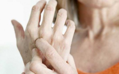 Làm thế nào để phòng ngừa biến chứng viêm khớp dạng thấp?