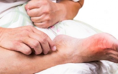 Vừa bị gout, vừa bị suy thận và viêm gan B có dùng được Hoàng Thống Phong?