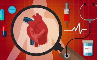 Suy tim sung huyết: Dấu hiệu, yếu tố nguy cơ và cách kiểm soát bệnh