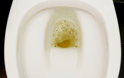 Tại sao nước tiểu của bạn lại có bọt?