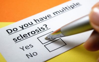 Nghĩ ngay đến bệnh đa xơ cứng khi có những dấu hiệu này!