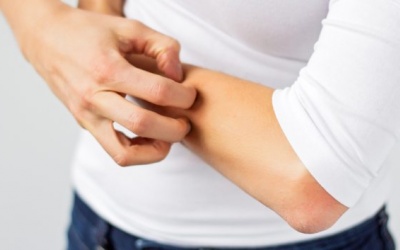 Người bị bệnh ngoài da có được hiến máu không?