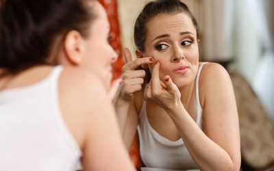 Dùng TPCN Nga Phụ Khang có gây mụn không?