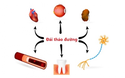 Làm sao phòng ngừa các biến chứng đái tháo đường nguy hiểm?
