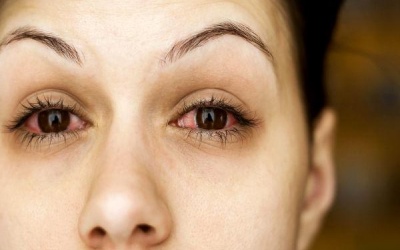 Làm sao để phòng các bệnh nhiễm trùng mắt trong mùa mưa?