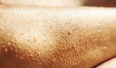 Tại sao chúng ta nổi da gà?