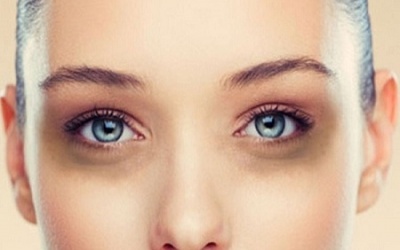 5 biện pháp tự nhiên giúp bạn tạm biệt quầng thâm và bọng mắt