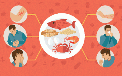 Phải làm gì khi xuất hiện các triệu chứng dị ứng thực phẩm?