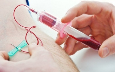 5 nguyên nhân gây thiếu máu mà bạn không hề ngờ tới