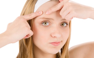 Trẻ bị mụn trứng cá trong tuổi dậy thì có hết mụn khi trưởng thành không?