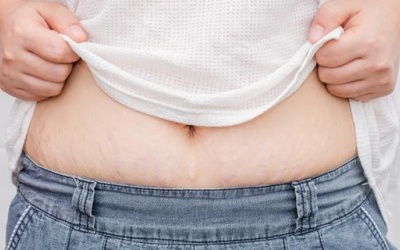Trị rạn da: Hãy áp dụng nhanh 4 mẹo với nha đam!