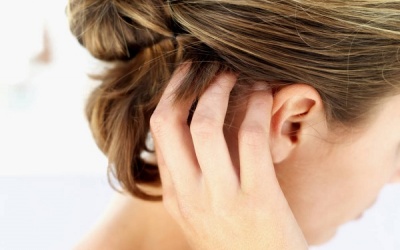 Viêm da đầu tiết bã gây ngứa ngáy, khó chịu phải làm sao?