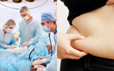 Vì sao dễ bị tăng cân sau phẫu thuật?