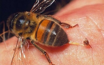 5 bước bạn cần nhớ khi xử trí vết ong đốt