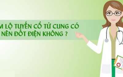Điều trị viêm lộ tuyến cổ tử cung: Nên hay không nên diệt tuyến