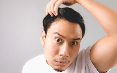 9 dấu hiệu hói đầu cần biết trước khi quá muộn
