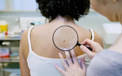 7 triệu chứng ung thư da mà bạn không thể nhìn thấy