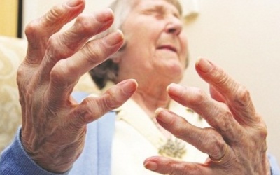 Viêm khớp dạng thấp dễ nhầm lẫn với những căn bệnh nào?