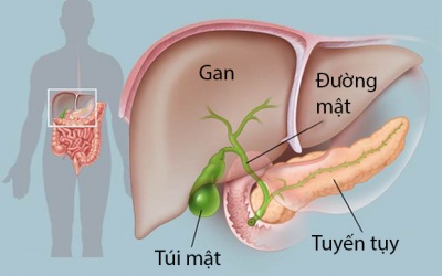 Người bị viêm xơ đường mật ăn uống thế nào để quản lý bệnh?