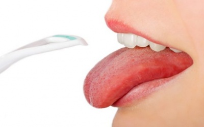 Vì sao bạn nên cạo lưỡi, vệ sinh lưỡi thường xuyên?