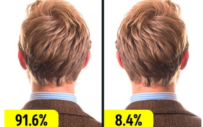 15 đặc điểm cơ thể độc đáo ít người có