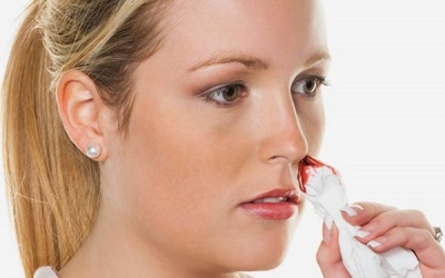 Có nên ngừng sử dụng aspirin khi bị chảy máu cam không?