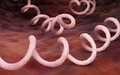 Infographic: 4 giai đoạn của bệnh giang mai