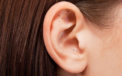 Cách xử lý mụn đầu đen trong tai đơn giản nhất