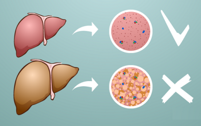 12 thực phẩm tốt cho người bệnh gan nhiễm mỡ