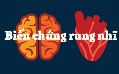 Người bệnh rung nhĩ cẩn thận với 2 biến chứng có thể gây tử vong