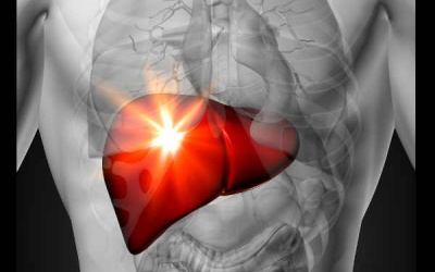 Những dấu hiệu cho thấy bạn đang bị gan nhiễm mỡ