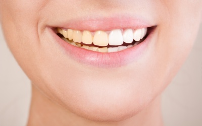 Video: Điểm danh những đồ ăn thức uống khiến hàm răng ố vàng