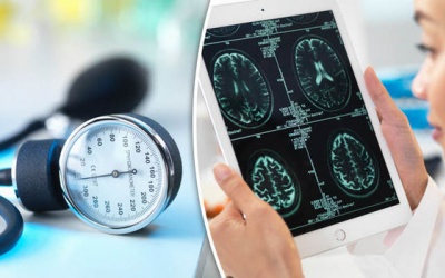 Phụ nữ độ tuổi 40 bị tăng huyết áp dễ mắc sa sút trí tuệ