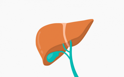 Tip phòng ngừa sỏi mật chỉ bằng kiểm soát cân nặng, chế độ ăn