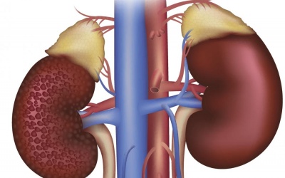 Bạn biết gì về bệnh thận đái tháo đường?