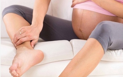 Giãn tĩnh mạch ở chân, bà bầu cần lưu ý điều gì?