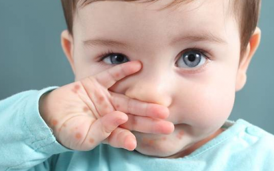 Trẻ sơ sinh bị tay chân miệng, bố mẹ nên làm gì?