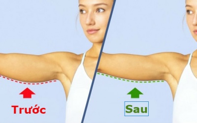 6 động tác giúp cánh tay thon gọn và săn chắc hơn