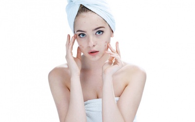 Khám phá 'sinh, lão, bệnh, tử' của mụn trứng cá