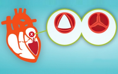 Trắc nghiệm: Bạn biết gì về van tim của mình?