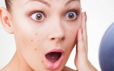 Những loại thực phẩm gây mụn, nếp nhăn và lão hóa nhanh