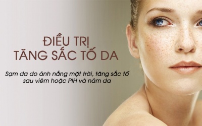 Có những phương pháp điều trị tăng sắc tố da nào?